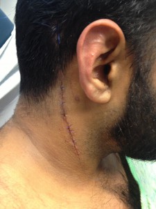 Corrections officials released this image of the officer's wound.
