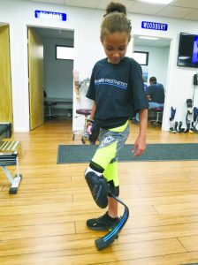 ProstheticLeg 1 768x1024 1